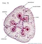 04_OvaryTS_labels.jpg