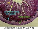 duodenum_ts_1