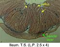 ileum_ts