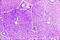 liver